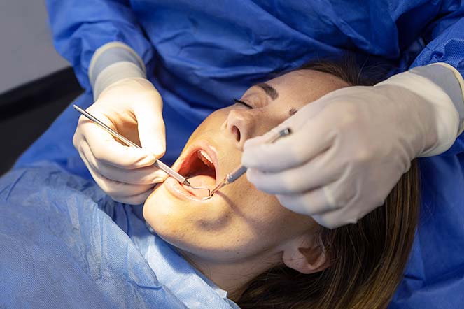 tooth sxtraction img