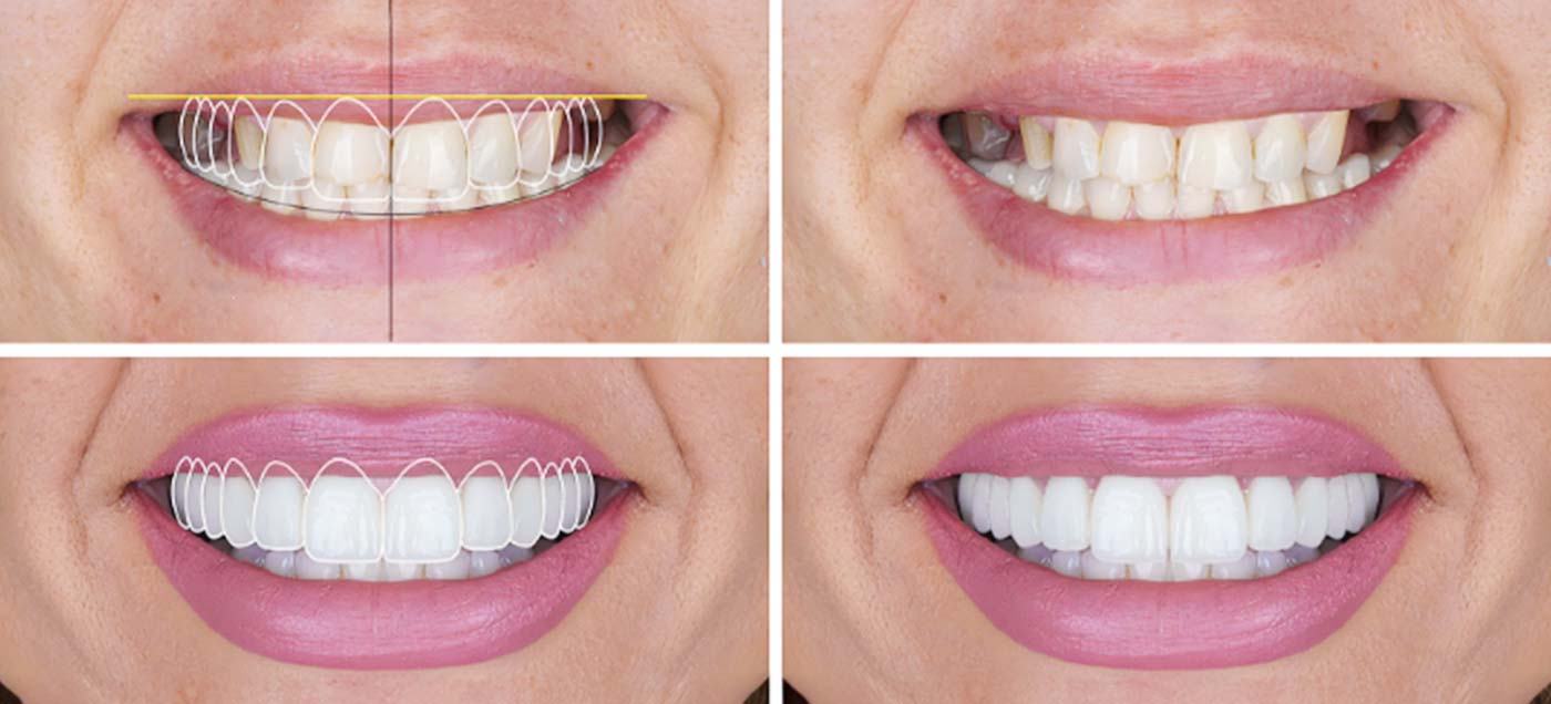 Cosmetic Periodontal banner