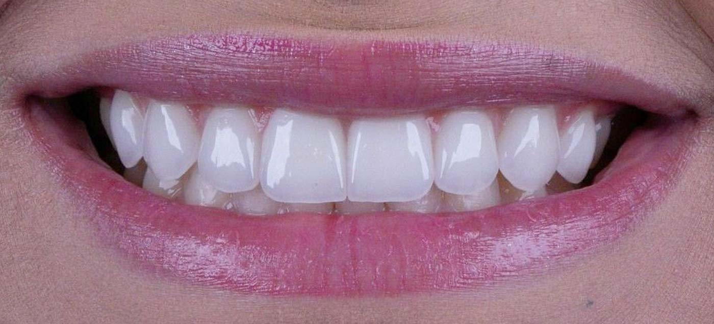 Hard and Soft Tissue banner