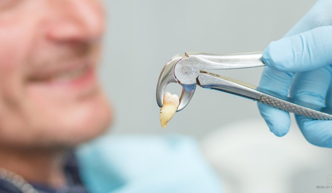 Aftercare of Tooth Extraction: Supporting Comfortable Healing