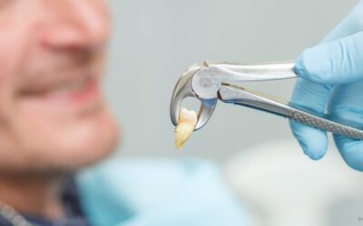 Aftercare of Tooth Extraction: Supporting Comfortable Healing
