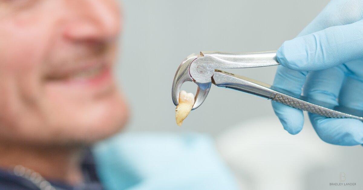 Aftercare Tooth Extraction Aftercare Tooth Extraction