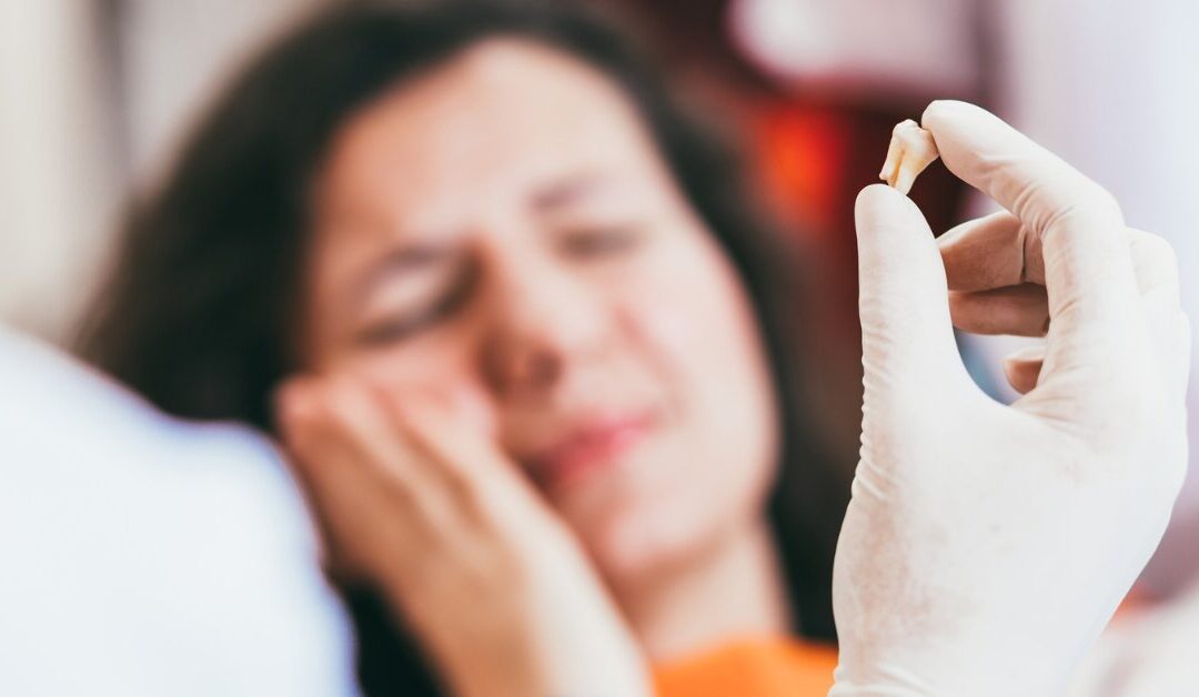 Is Tooth Extraction Painful? What to Expect
